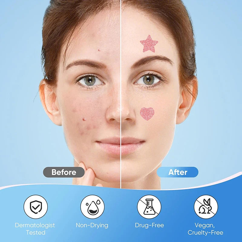 156/276Pcs Pimple Patch Sticker Waterproof Treat Pimple Remover Tool Facial Mask Skin Care Hidden Pimple